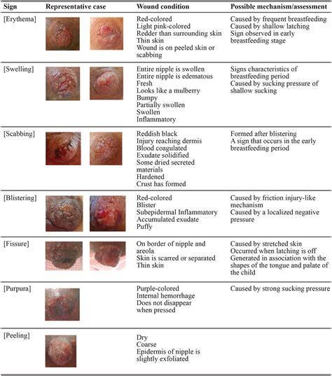 dry skin on nipple